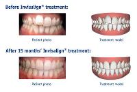 Dental Treatment Services -  image 2